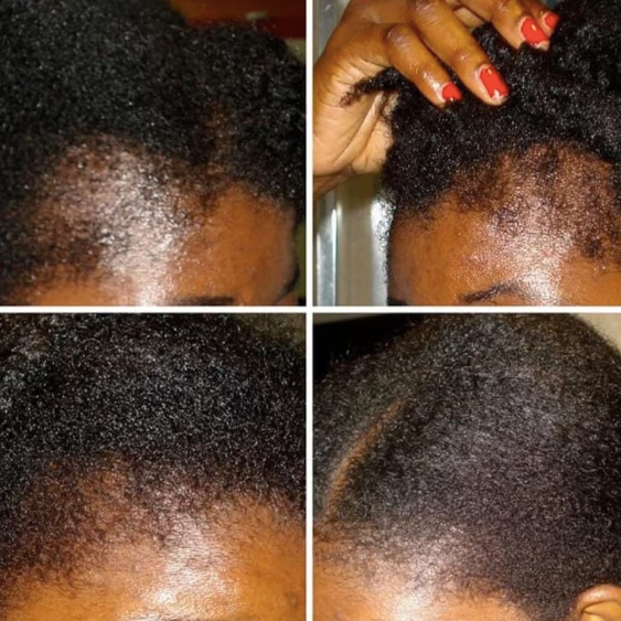 Miracle Hair Oil *Mega Growth*