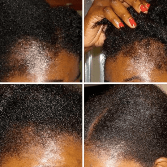 Dark Slate Gray MEGA GROWTH hair oil Ethnic Gals